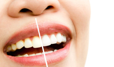 Cosmetic teeth or dental decoration